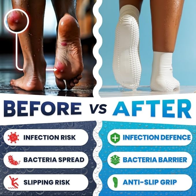 Verruca Socks (Kids) Before vs After